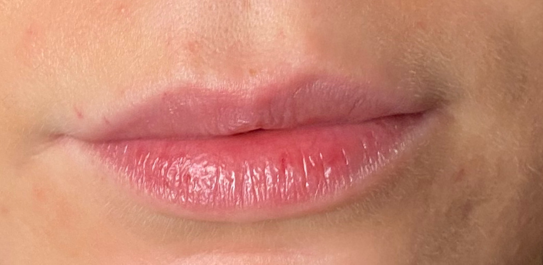 før-lips2